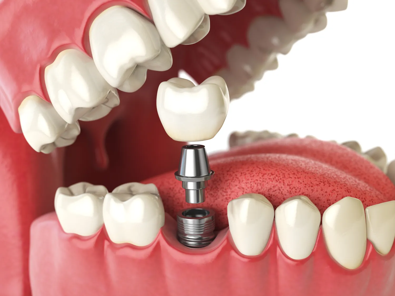 Najlepszy dentysta Szczecin