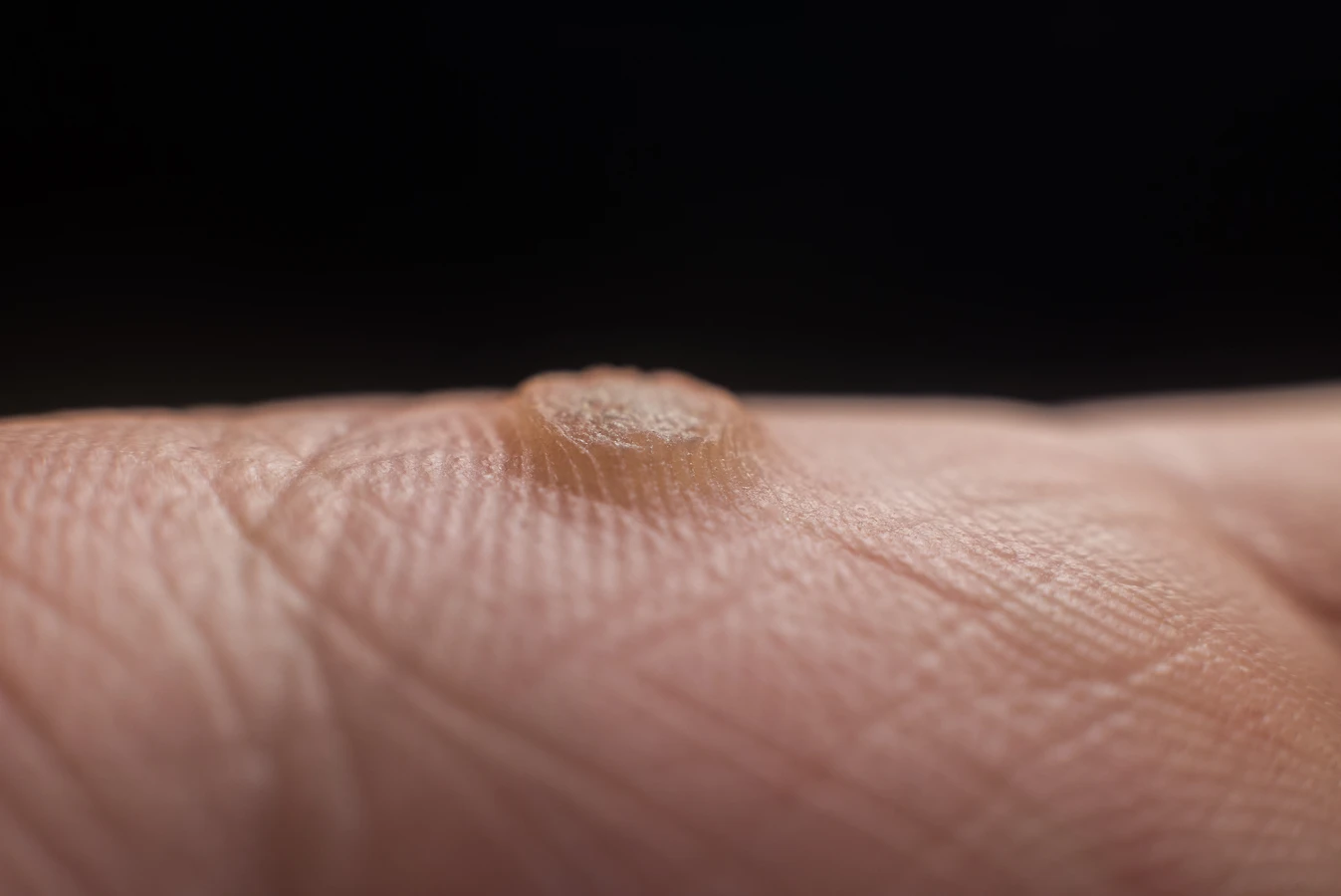 Podologia - czym jest i kiedy warto udać się do podologa?